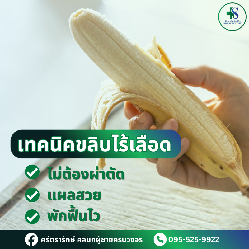 ขลิบไร้เลือด-ศรีตรารักษ์-คลินิกผู้ชายครบวงจร