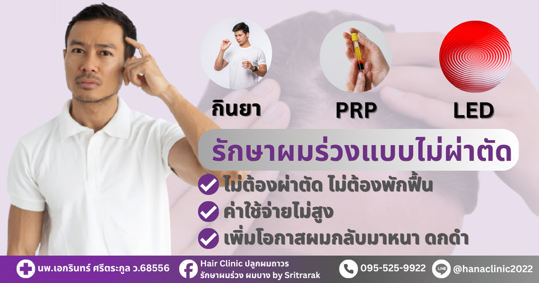 รักษาผมร่วง-ผมบาง-หัวล้าน-ฮานาคลินิก-โดย-ศรีตรารักษ์