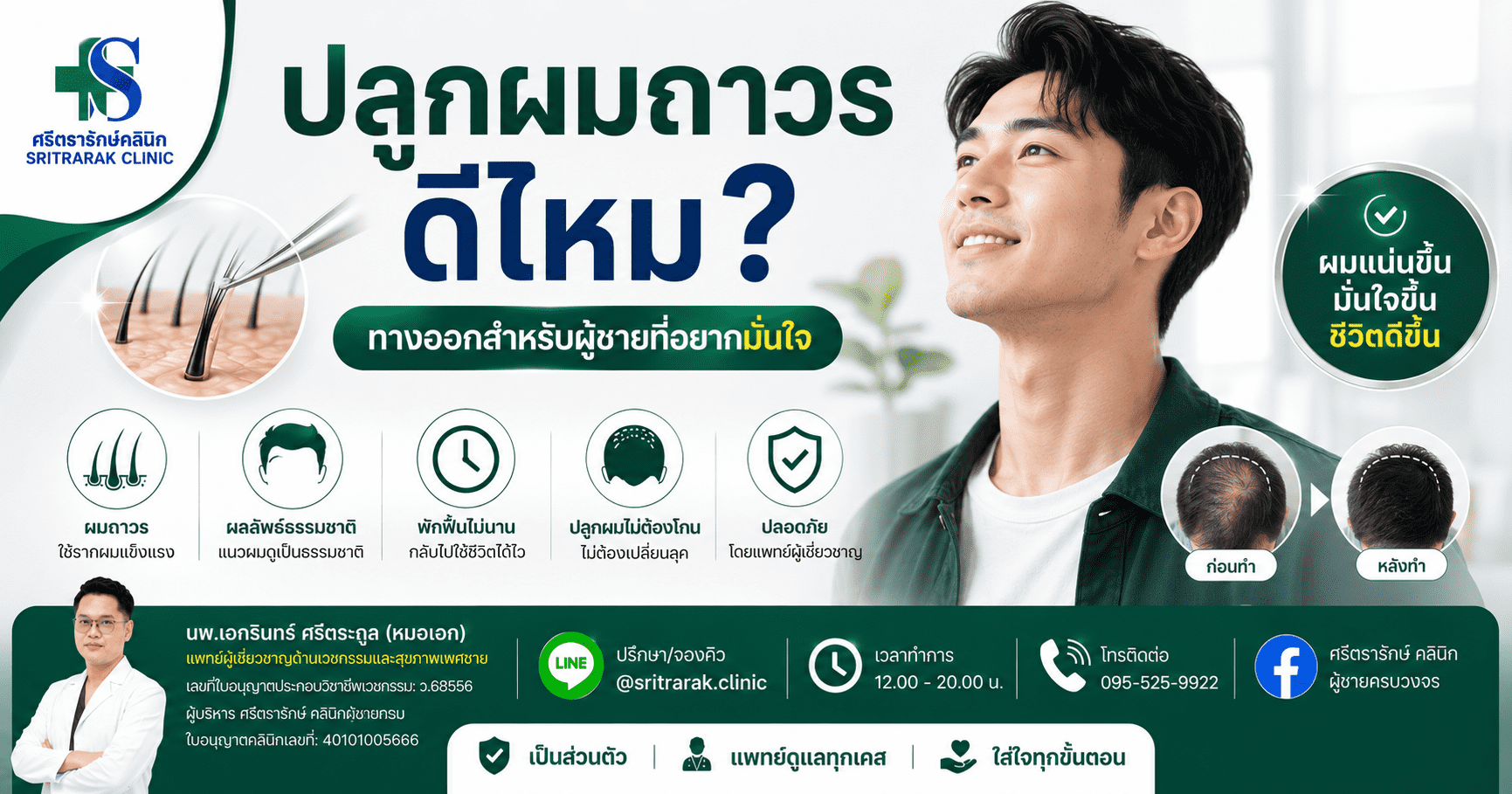ปลูกผมถาวรดีไหม_optimized